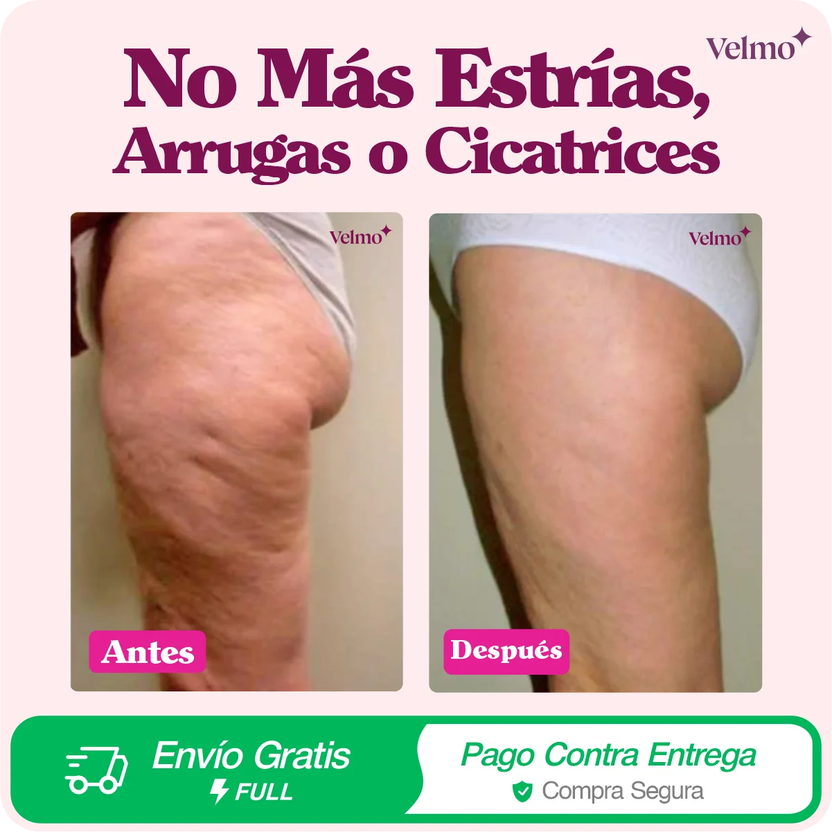 Crema ADEUS Rosa | Anti Estrías
