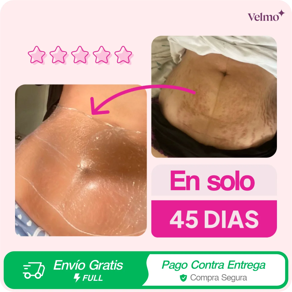 Crema ADEUS Rosa | Anti Estrías