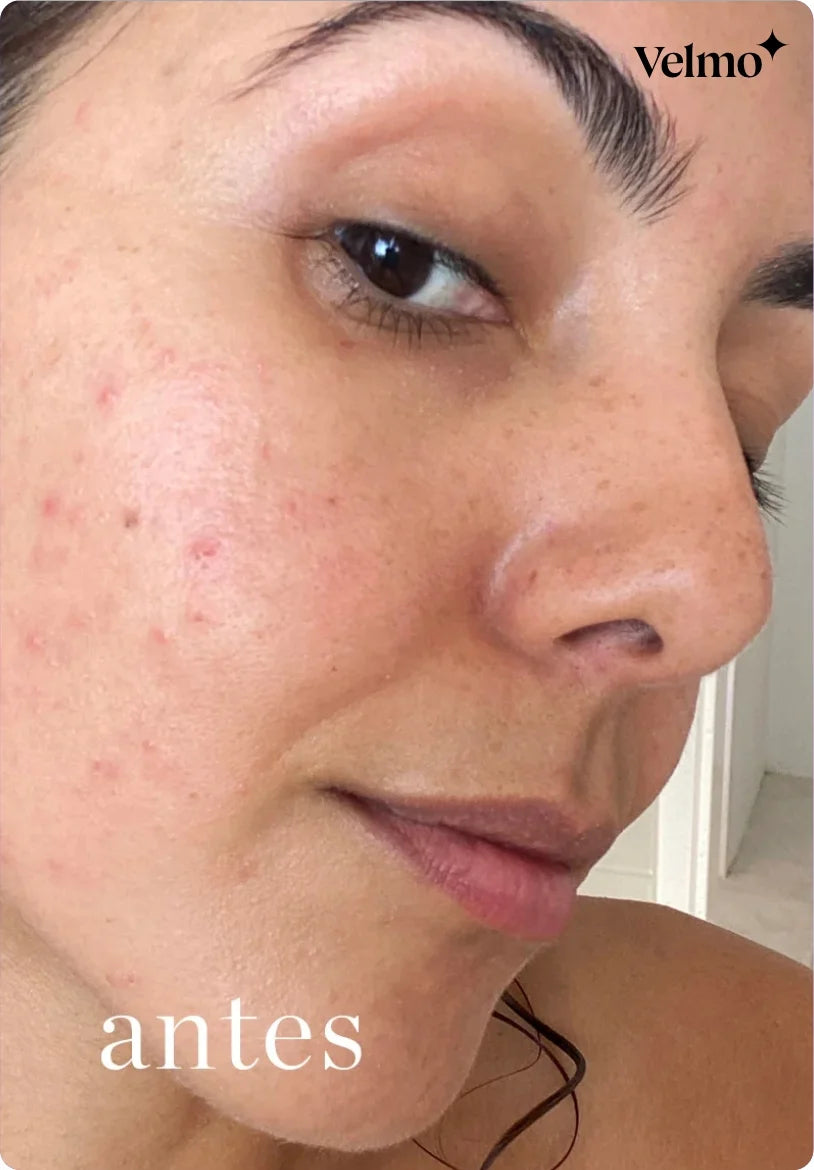 Crema 345 Cream Relief de Dr. Althea